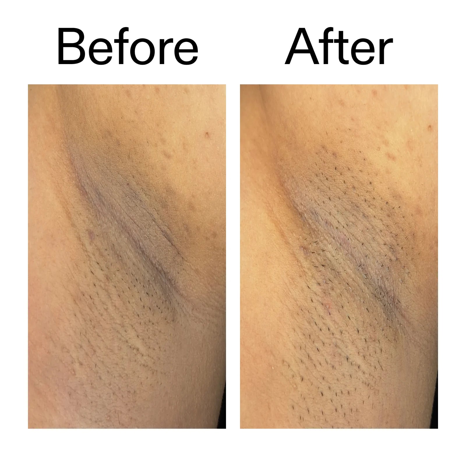 Smooth & Even Glycolic Body Stick