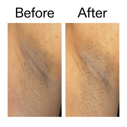 Smooth & Even Glycolic Body Stick