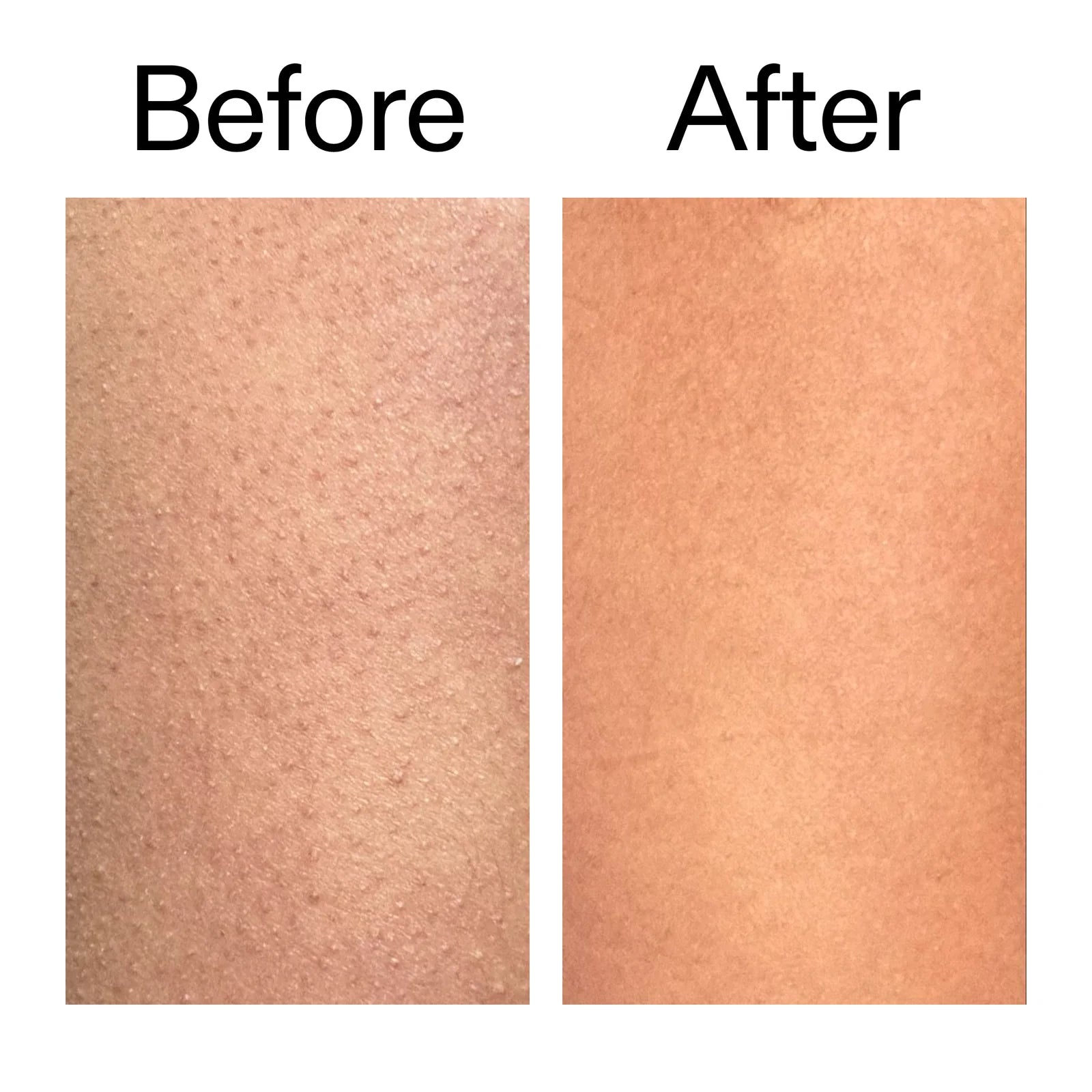 Smooth & Even Glycolic Body Stick