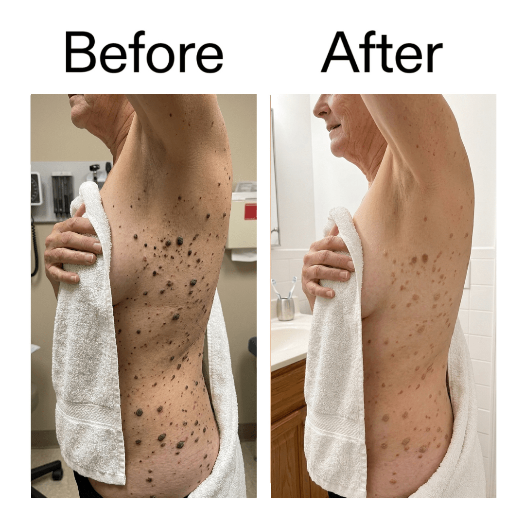 Smooth & Even Glycolic Body Stick - Equalize Labs